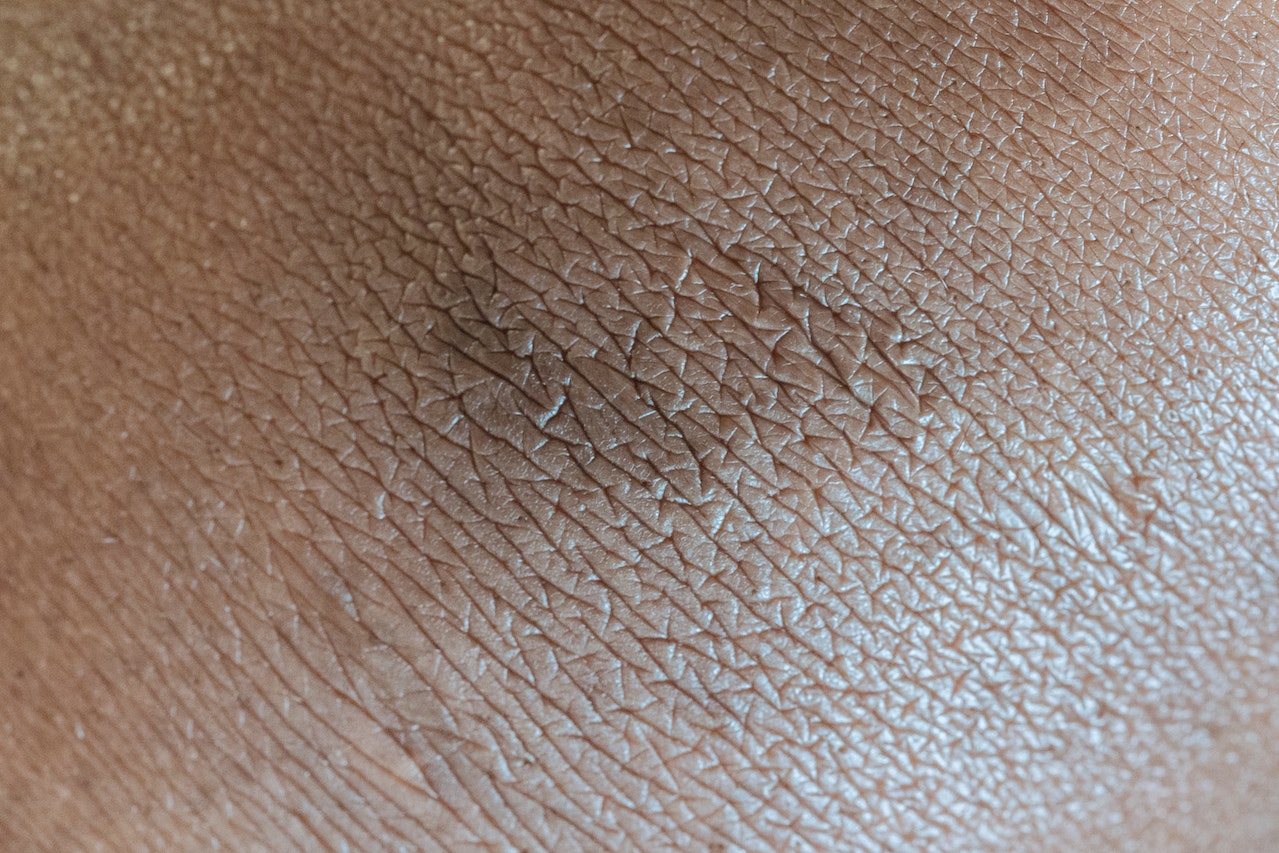 pigmented skin and wrinkles