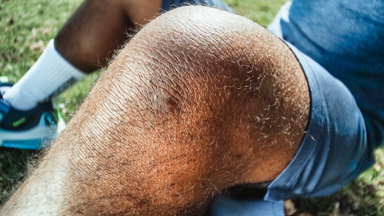 Knee-Swelling-Treatment
